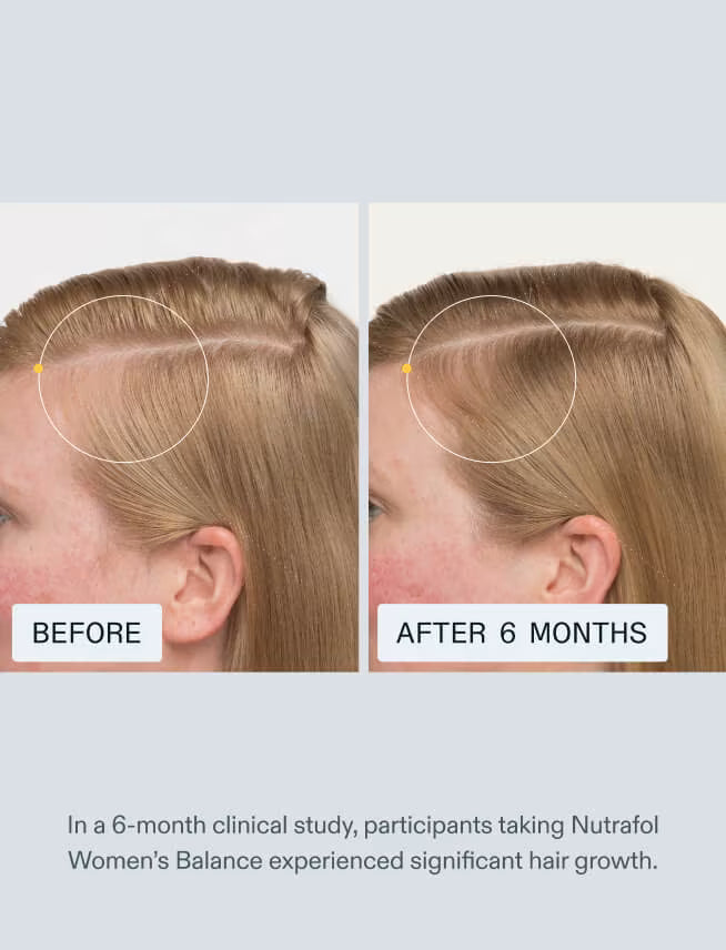 Nutrafol - Women's Balance