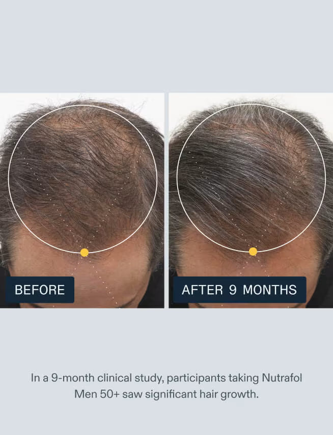 Nutrafol - Men 50+